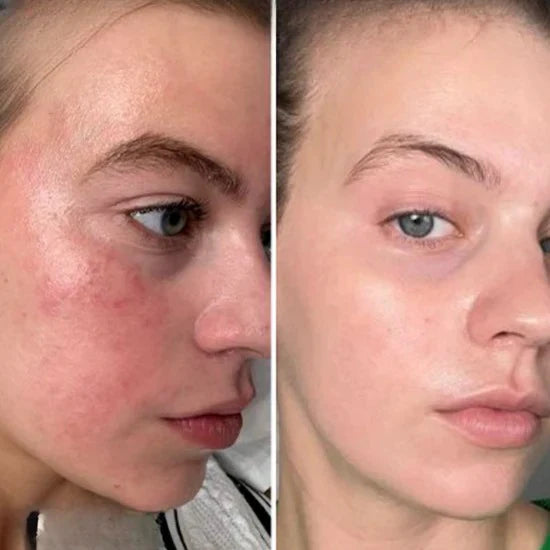 Collagen Niacinamide Jelly Cream