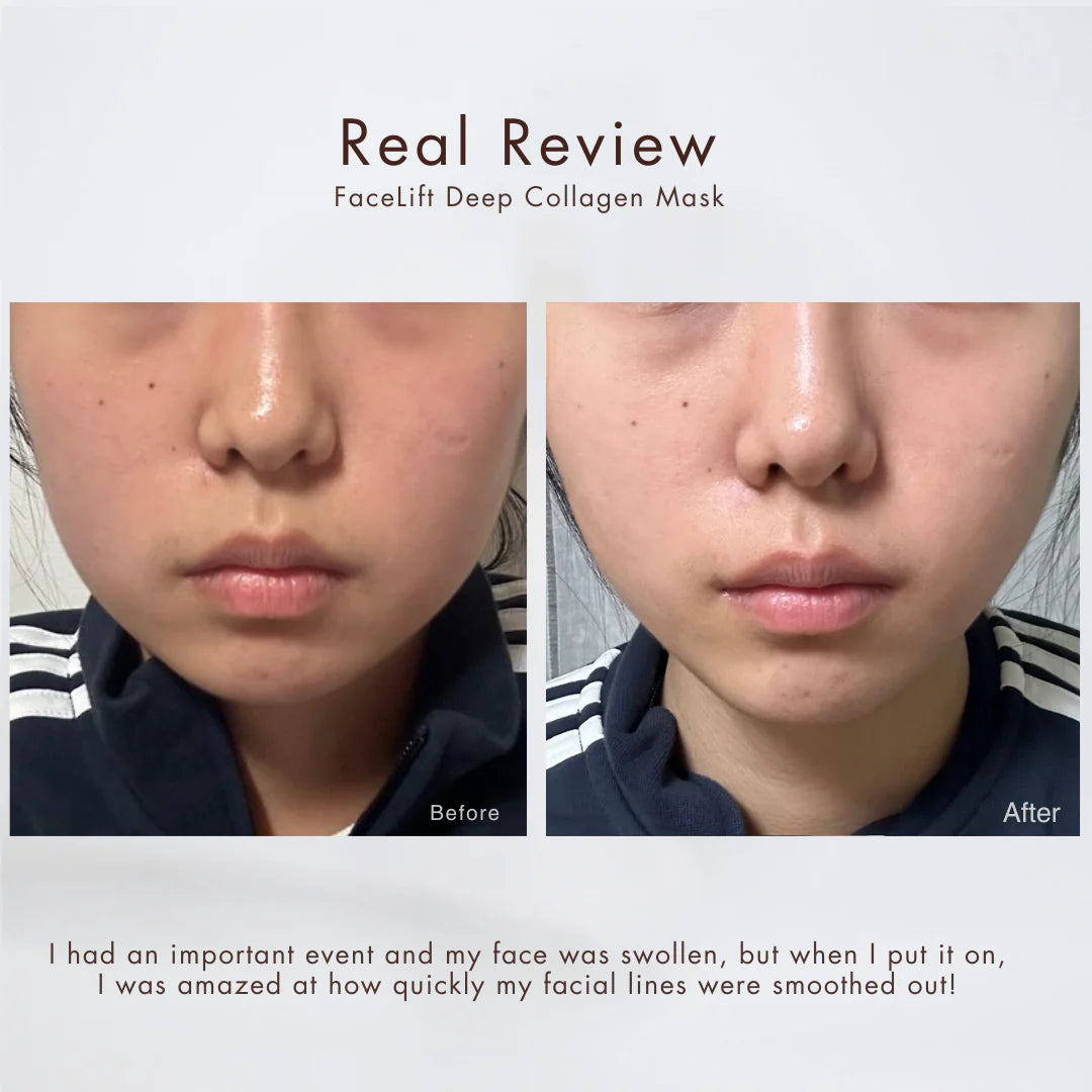 CollagenLift™ Face Mask