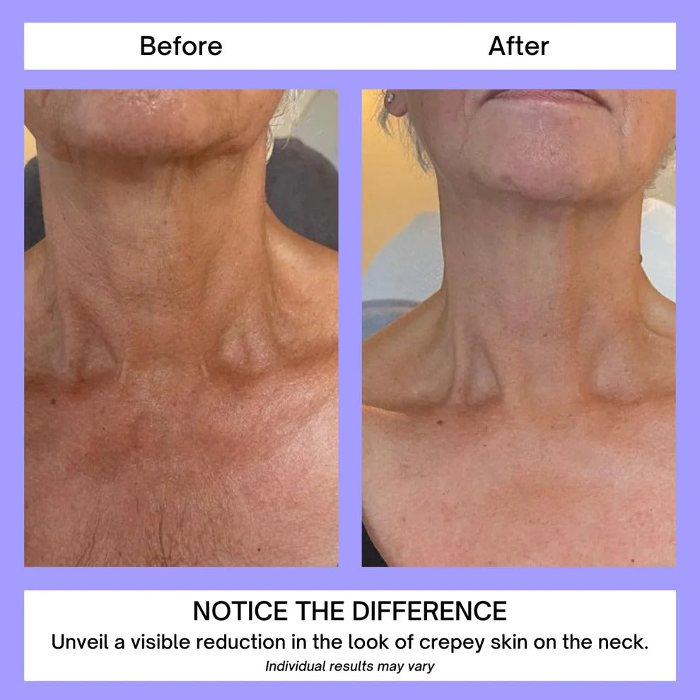 NeckSculpt™ Neck Tightening & Lift Cream