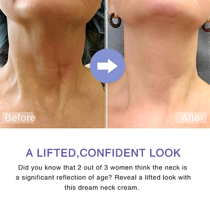 NeckSculpt™ Neck Tightening & Lift Cream